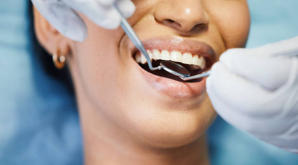Best Emergency Dental Care for Broken or Chipped Teeth in Boardman, OR
